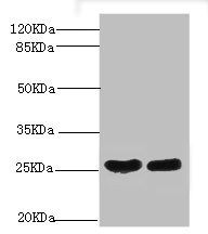 C-reactive protein antibody