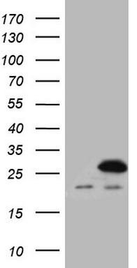 C Reactive Protein Antibody
