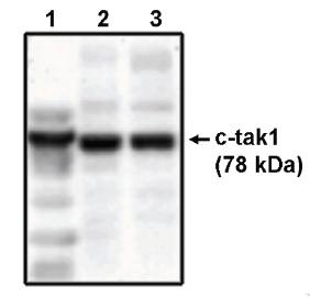 Sheep Human TAK1 Antibody