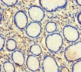 C-type lectin domain family 18 member A antibody