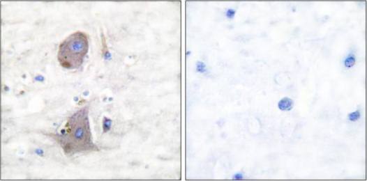 GLUT1 Antibody
