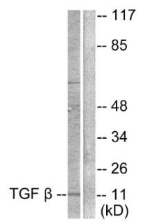 TGF β3 Antibody