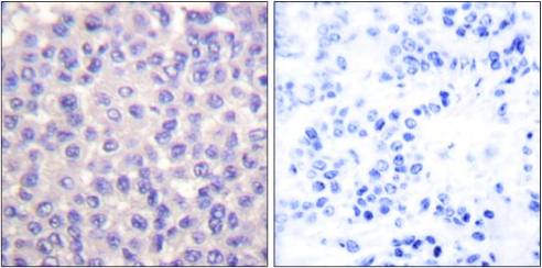 TGF β3 Antibody