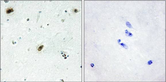 ABL1 Antibody