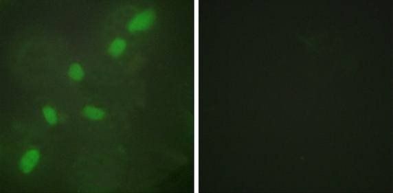 hnRNP A2/B1 Antibody