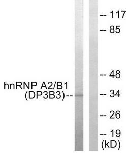 hnRNP A2/B1 Antibody
