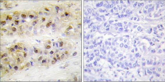 RORA Antibody