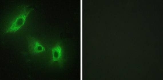ACV1B Antibody