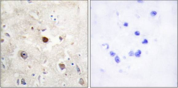 p57KIP2 Antibody