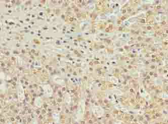 C10orf91 Antibody