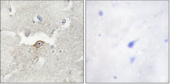 LMTK2 Antibody