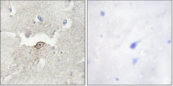 LMTK2 antibody