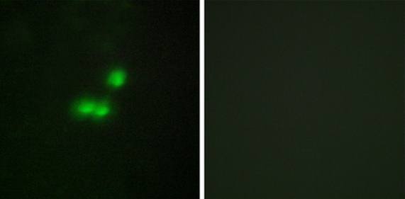 BRF1 antibody