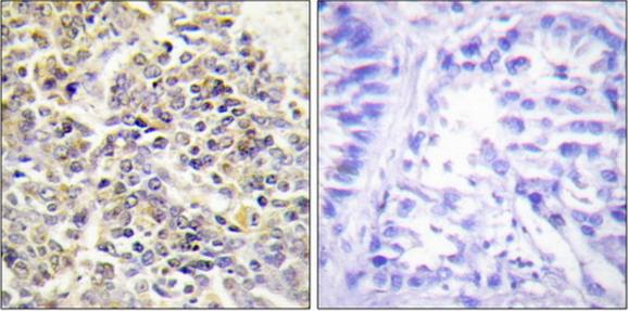 ASC Antibody