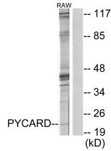ASC Antibody