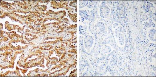 GIT1 Antibody