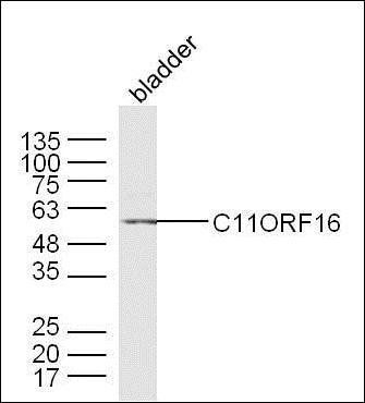 C11ORF16 antibody