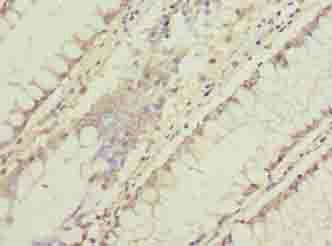 C11orf53 Antibody