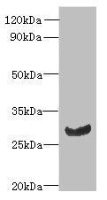 C11orf68 antibody