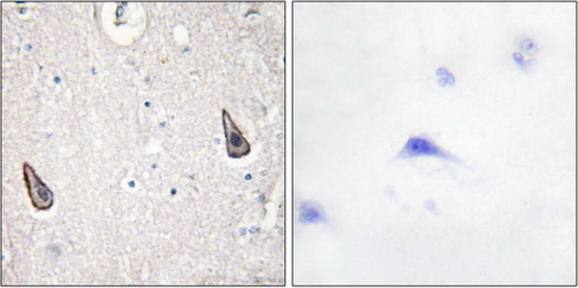 ADCY5/6 antibody