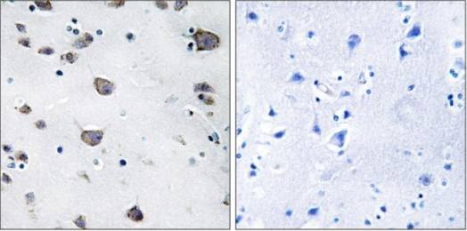 AIFM3 Antibody