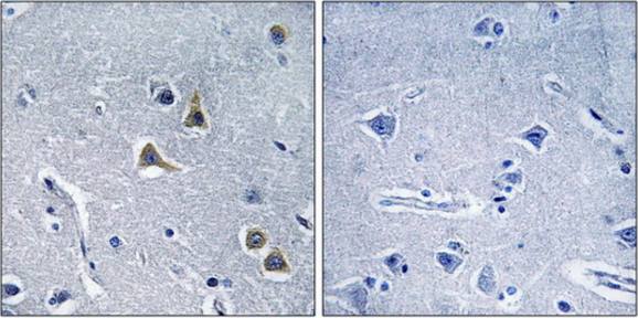 ARRDC2 Antibody