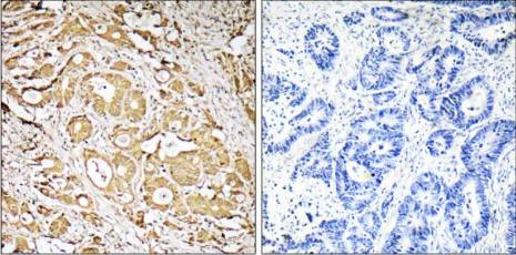 CDH16 Antibody
