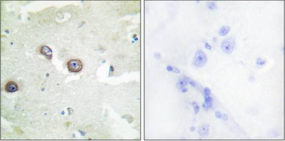 CDH4 Antibody