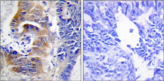 CDCA3 antibody