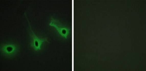 Collagen V alpha 3 antibody