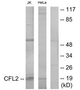 Cofilin Antibody