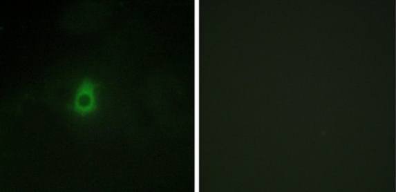 Cytochrome P450 2E1 Antibody