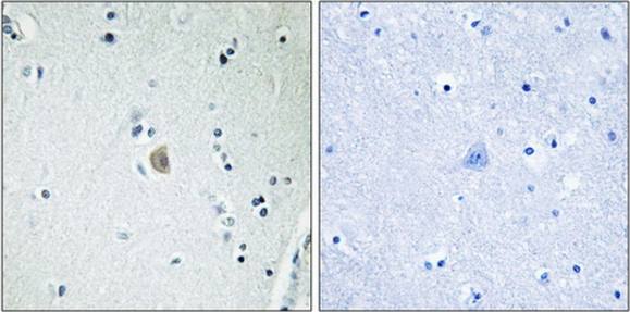 Cytochrome P450 2E1 Antibody