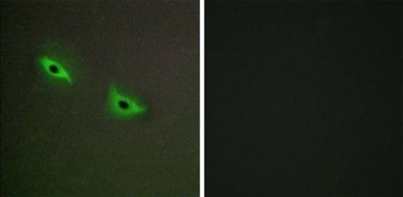 Cytochrome P450 2S1 antibody