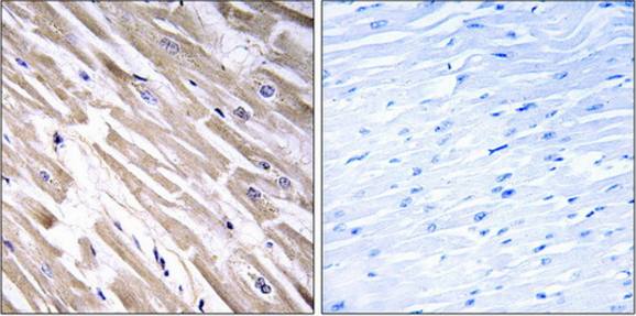 FGF18 antibody