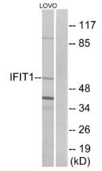 IFIT1 Antibody