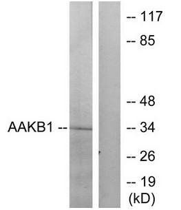 PRKAB1 Antibody
