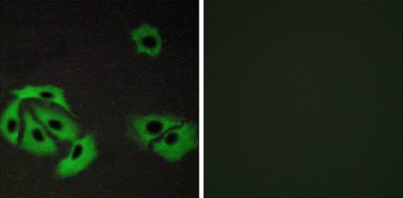 BAX antibody