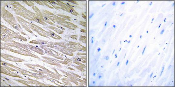 LAMA4 antibody