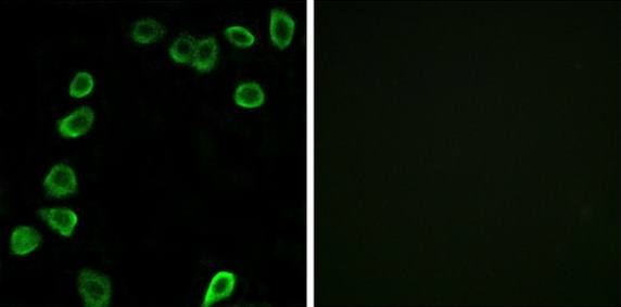 LAMA4 Antibody