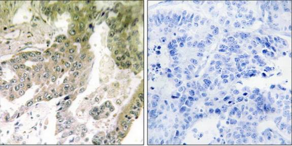 LAMA5 Antibody