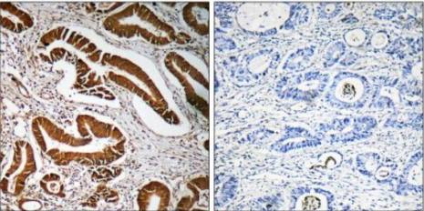 MEN1 Antibody