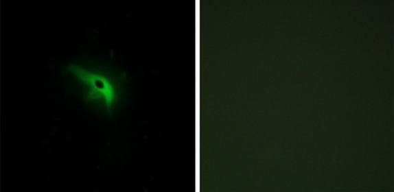 TPIP1 Antibody