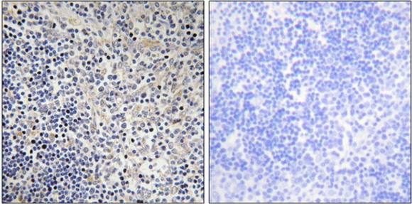 TPIP1 Antibody