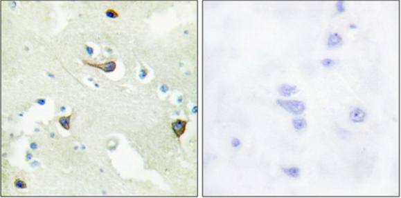EPHB1/2/3 Antibody