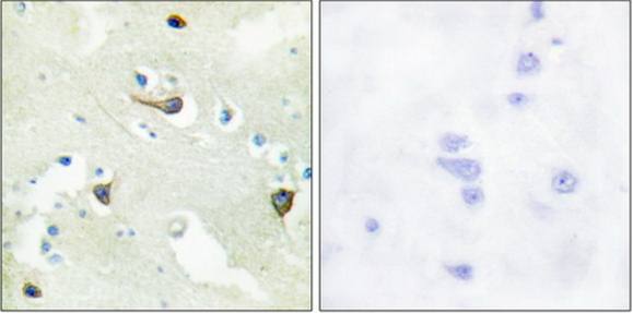 EPHB1/2/3 antibody