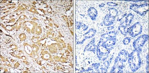 FUT3 Antibody