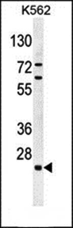C15orf41 antibody
