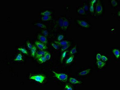 C17orf62 antibody