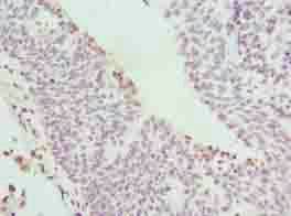 CYBC1 Antibody